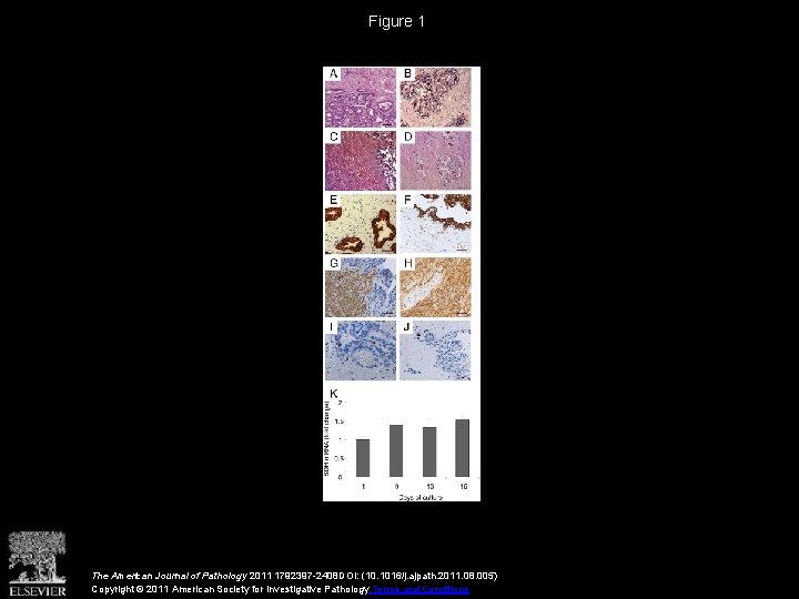 Figure 1 The American Journal of Pathology 2011 1792397 -2408 DOI: (10. 1016/j. ajpath.