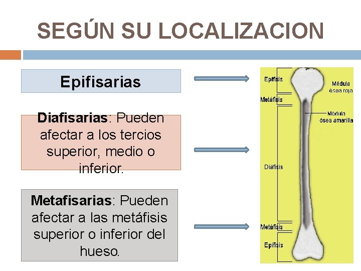 SEGÚN SU LOCALIZACION Epifisarias Diafisarias: Pueden afectar a los tercios superior, medio o inferior.