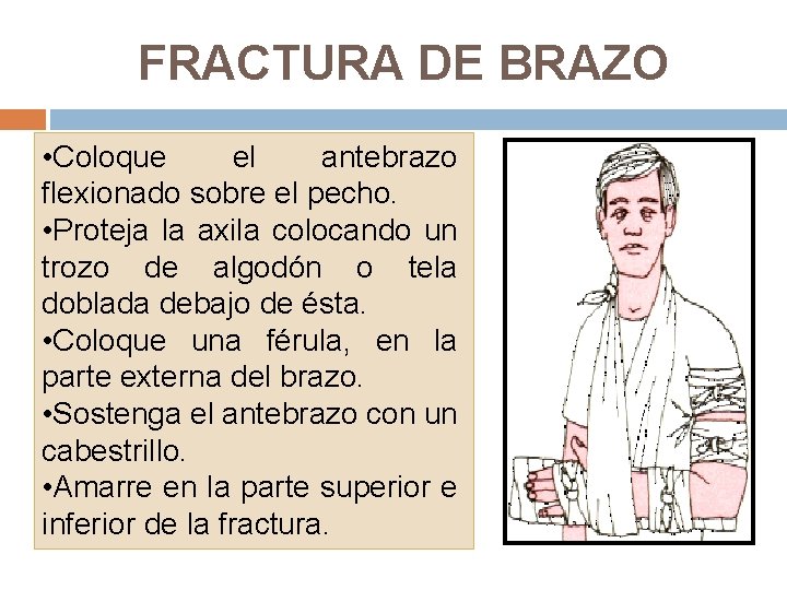 FRACTURA DE BRAZO • Coloque el antebrazo flexionado sobre el pecho. • Proteja la