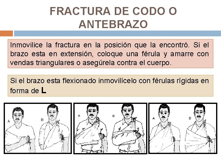 FRACTURA DE CODO O ANTEBRAZO Inmovilice la fractura en la posición que la encontró.