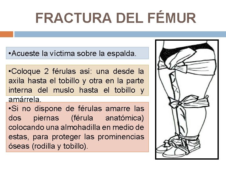 FRACTURA DEL FÉMUR • Acueste la víctima sobre la espalda. • Coloque 2 férulas