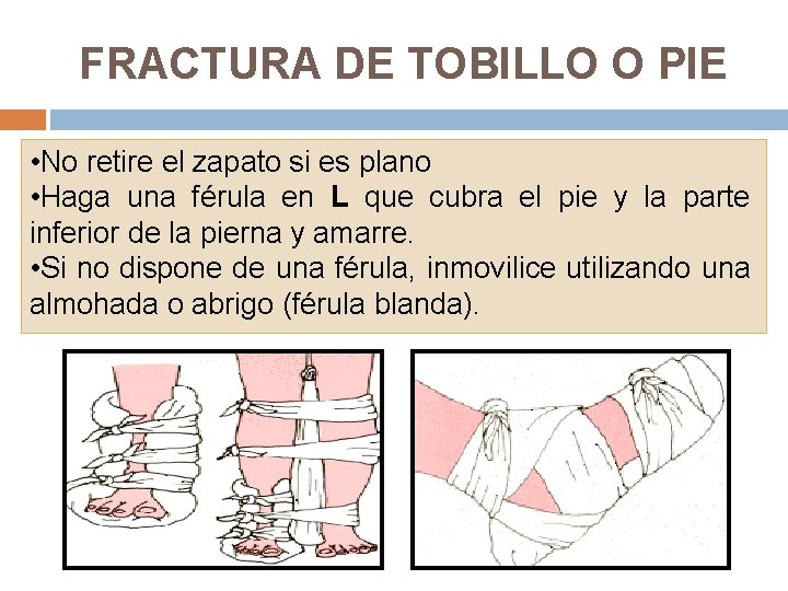 FRACTURA DE TOBILLO O PIE • No retire el zapato si es plano •
