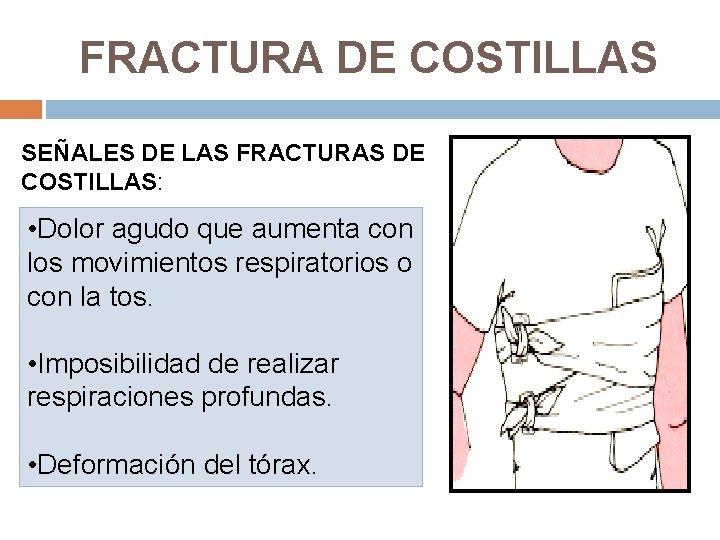 FRACTURA DE COSTILLAS SEÑALES DE LAS FRACTURAS DE COSTILLAS: • Dolor agudo que aumenta