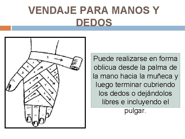 VENDAJE PARA MANOS Y DEDOS Puede realizarse en forma oblicua desde la palma de