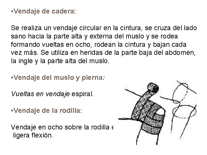  • Vendaje de cadera: Se realiza un vendaje circular en la cintura, se