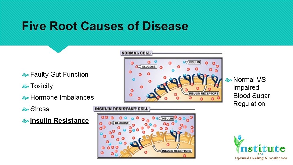 Five Root Causes of Disease Faulty Gut Function Toxicity Hormone Imbalances Stress Insulin Resistance