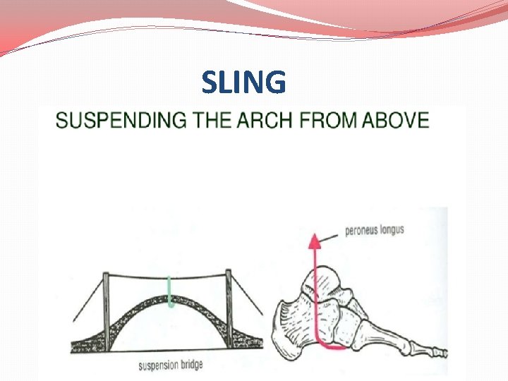 SLING 