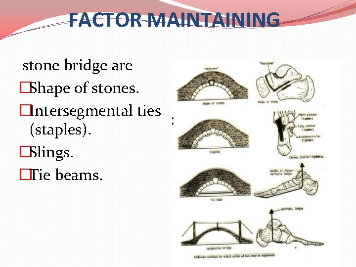 FACTOR MAINTAINING stone bridge are �Shape of stones. �Intersegmental ties (staples). �Slings. �Tie beams.