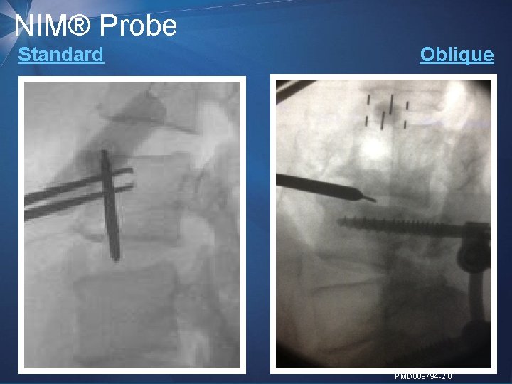 NIM® Probe Standard Oblique 16 | MDT Confidential PMD 009794 -2. 0 