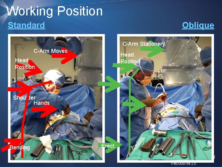 Working Position Standard Oblique C-Arm Stationery C-Arm Moves Head Position Shoulder Hands Bending Erect