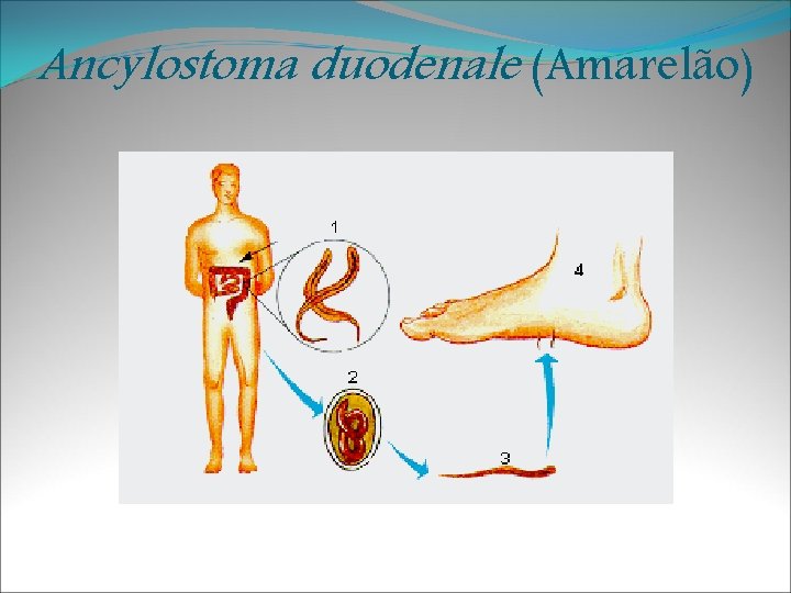 Ancylostoma duodenale (Amarelão) 