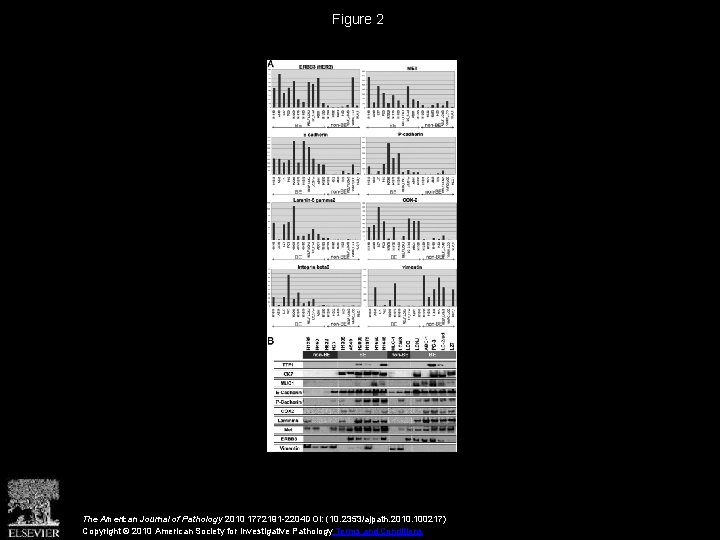 Figure 2 The American Journal of Pathology 2010 1772191 -2204 DOI: (10. 2353/ajpath. 2010.