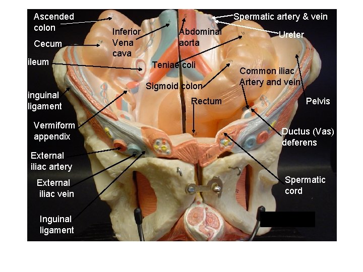 Ascended colon Cecum ileum inguinal ligament Vermiform appendix Spermatic artery & vein Inferior Vena