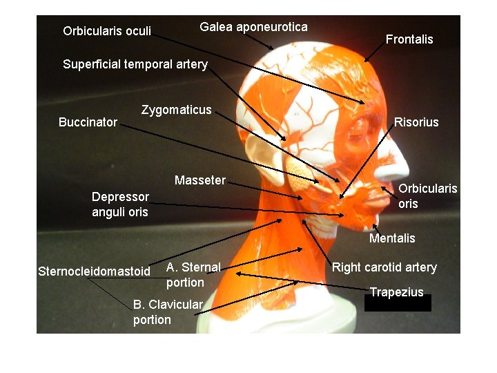 Orbicularis oculi Galea aponeurotica Frontalis Superficial temporal artery Buccinator Zygomaticus Masseter Depressor anguli oris