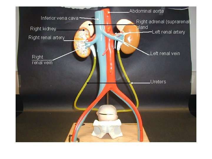 Abdominal aorta Inferior vena cava Right kidney Right adrenal (suprarenal) gland Left renal artery