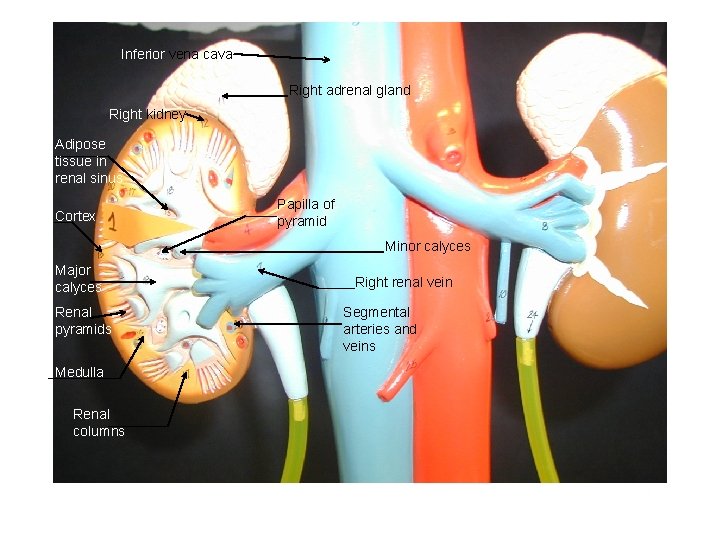 Inferior vena cava Right adrenal gland Right kidney Adipose tissue in renal sinus Cortex