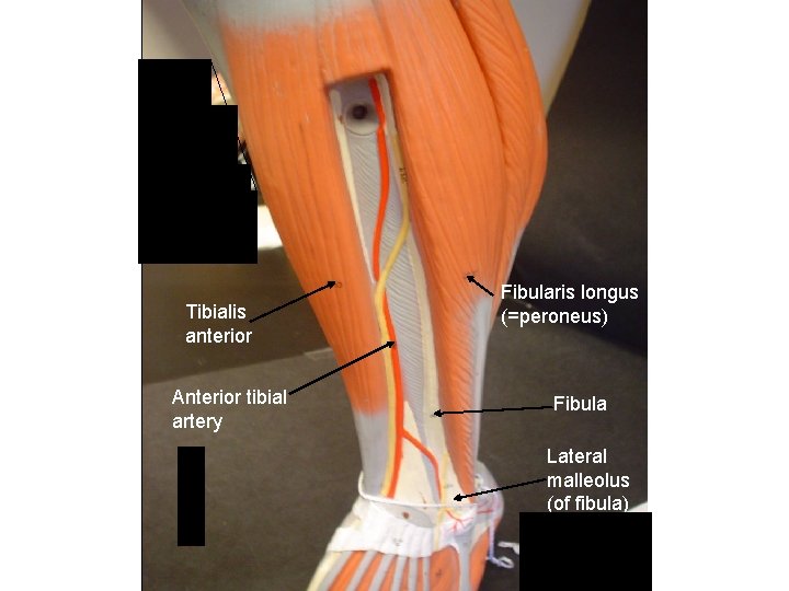 Tibialis anterior Anterior tibial artery Fibularis longus (=peroneus) Fibula Lateral malleolus (of fibula) 