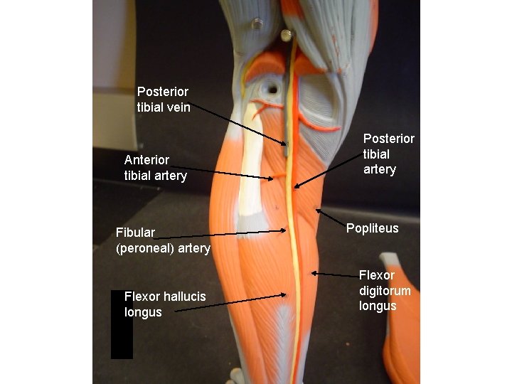Posterior tibial vein Anterior tibial artery Fibular (peroneal) artery Flexor hallucis longus Posterior tibial