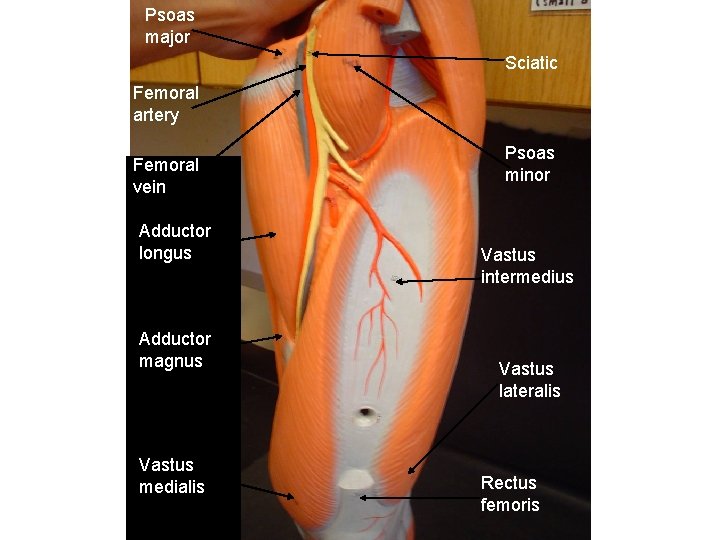 Psoas major Sciatic Femoral artery Femoral vein Adductor longus Adductor magnus Vastus medialis Psoas