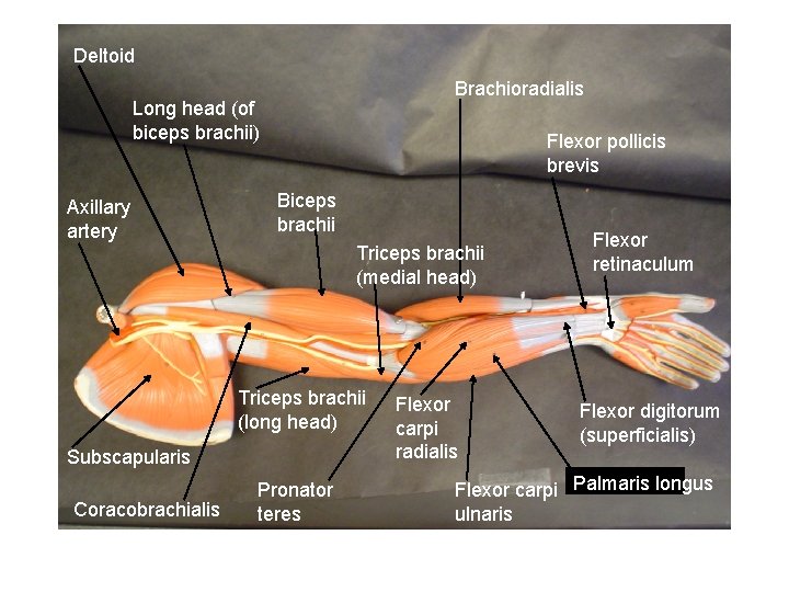 Deltoid Brachioradialis Long head (of biceps brachii) Axillary artery Flexor pollicis brevis Biceps brachii