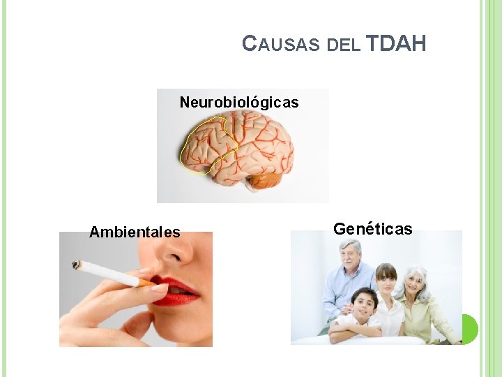 CAUSAS DEL TDAH Neurobiológicas Ambientales Genéticas 