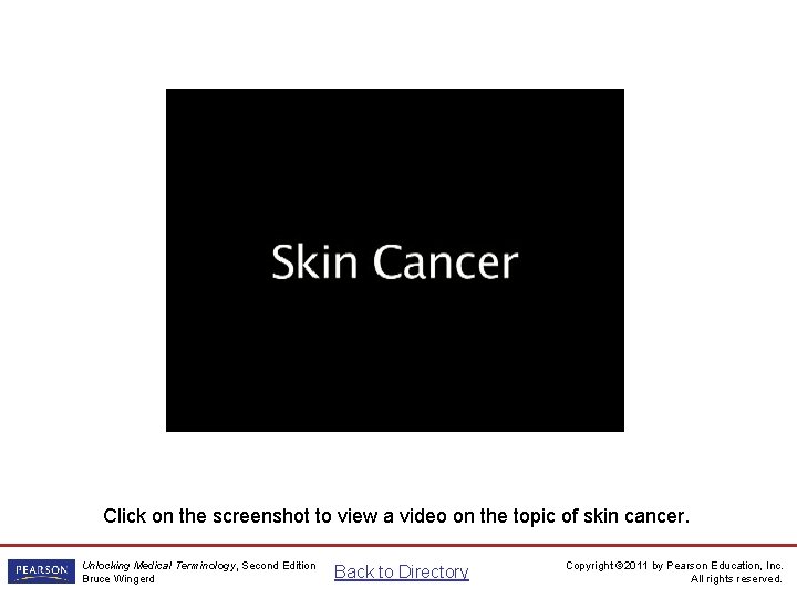 Skin Cancer Video Click on the screenshot to view a video on the topic