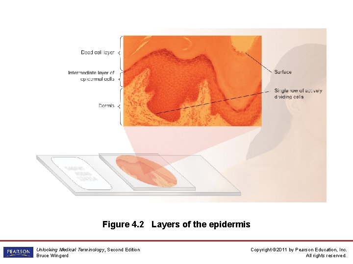 Figure 4. 2 Layers of the epidermis Unlocking Medical Terminology, Second Edition Bruce Wingerd