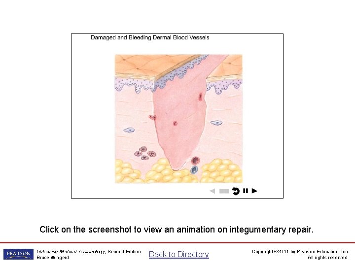 Integumentary Repair Animation Click on the screenshot to view an animation on integumentary repair.