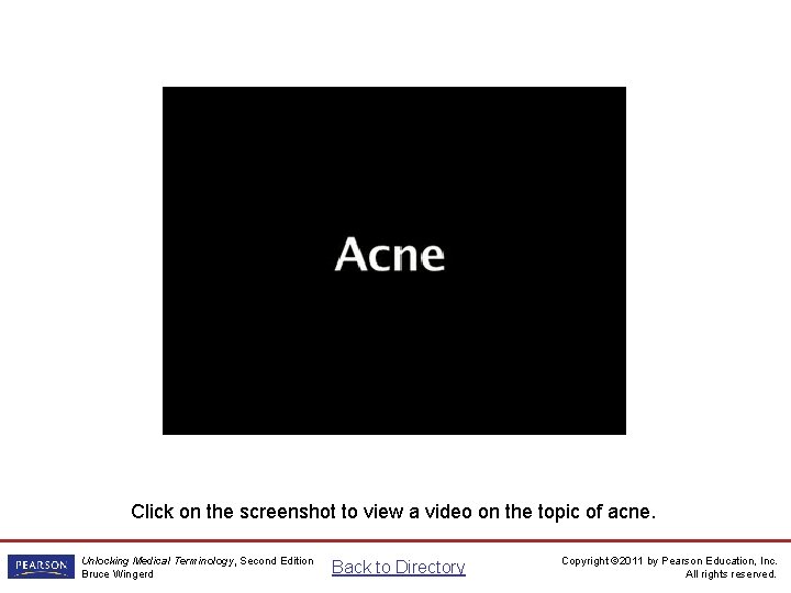 Acne Video Click on the screenshot to view a video on the topic of