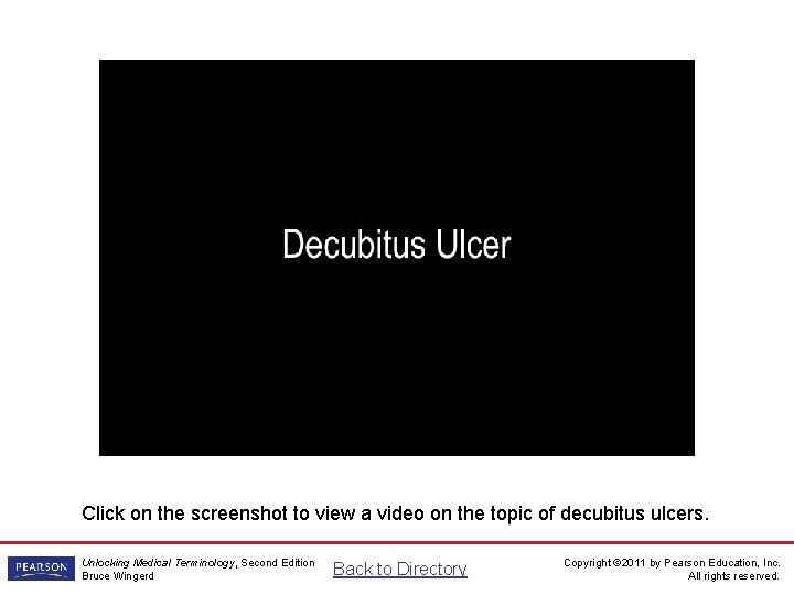 Decubitus Ulcer Video Click on the screenshot to view a video on the topic