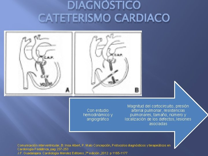 DIAGNÓSTICO CATETERISMO CARDIACO Con estudio hemodinámico y angiográfico Magnitud del cortocircuito, presión arterial pulmonar,