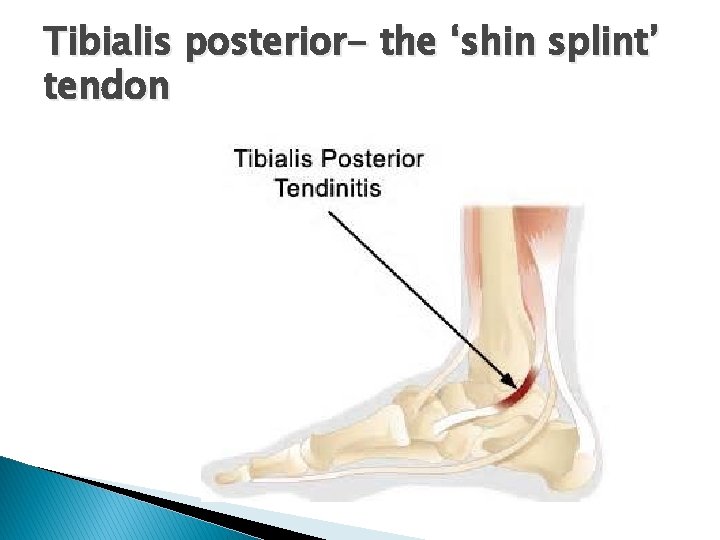 Tibialis posterior- the ‘shin splint’ tendon 