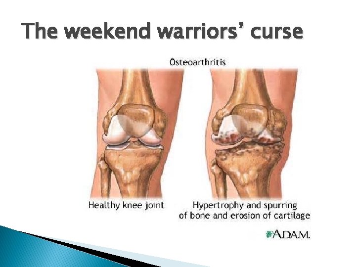 The weekend warriors’ curse 