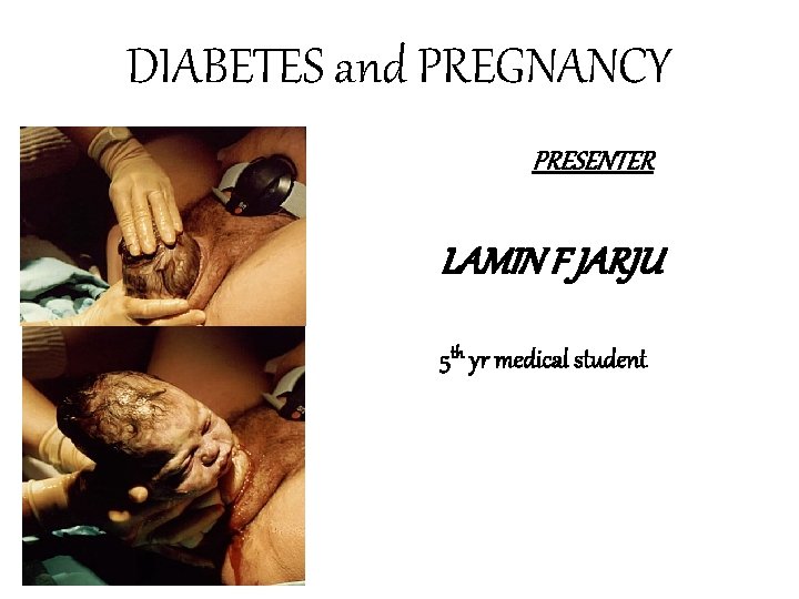 DIABETES and PREGNANCY PRESENTER LAMIN F JARJU 5 th yr medical student 