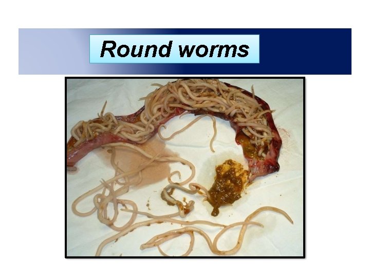 Round worms 