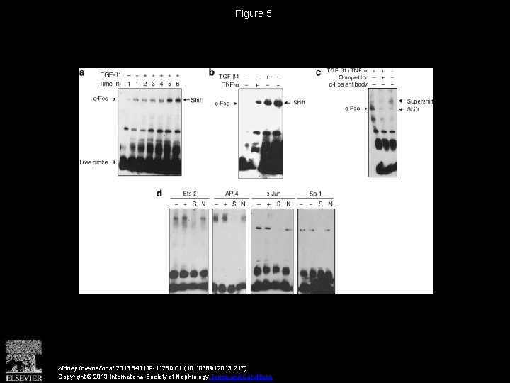 Figure 5 Kidney International 2013 841119 -1128 DOI: (10. 1038/ki. 2013. 217) Copyright ©