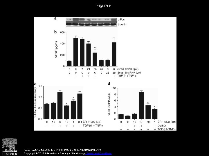 Figure 6 Kidney International 2013 841119 -1128 DOI: (10. 1038/ki. 2013. 217) Copyright ©