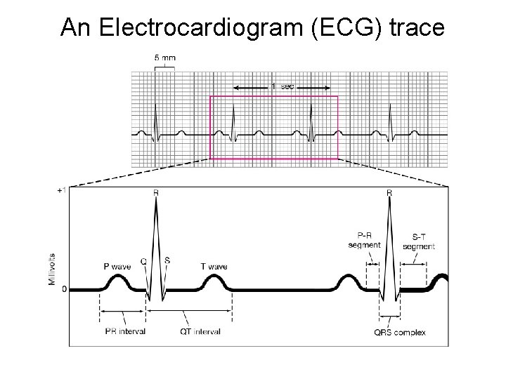 An Electrocardiogram (ECG) trace 