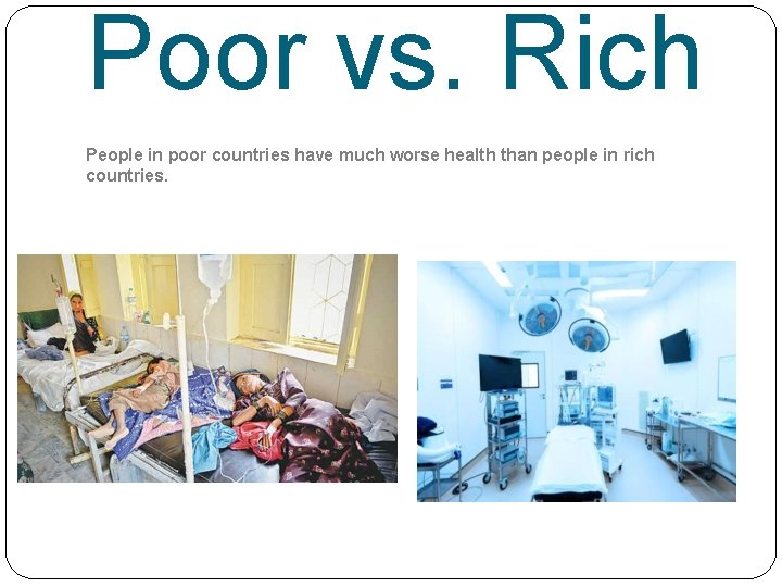 Poor vs. Rich People in poor countries have much worse health than people in
