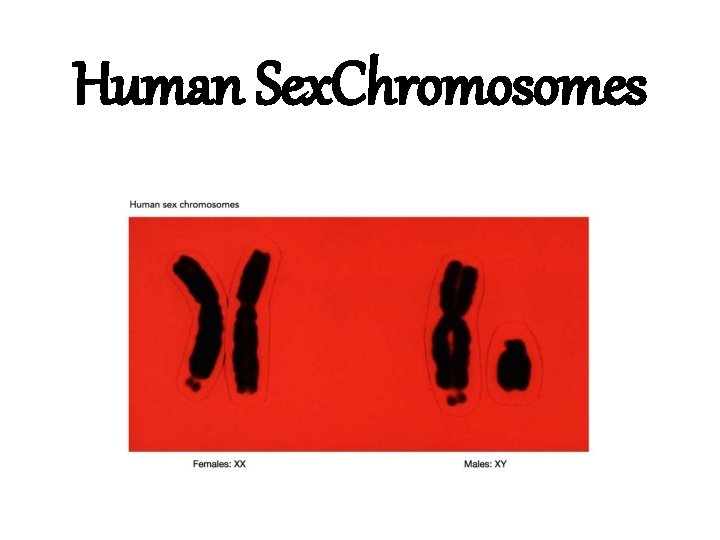 Human Sex. Chromosomes 