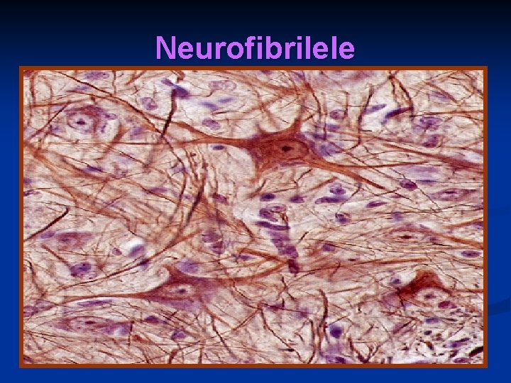 Neurofibrilele 