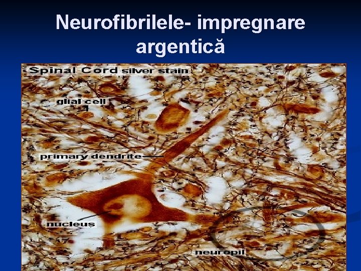 Neurofibrilele- impregnare argentică 