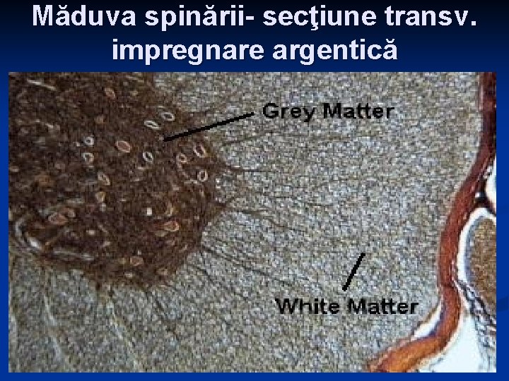 Măduva spinării- secţiune transv. impregnare argentică 