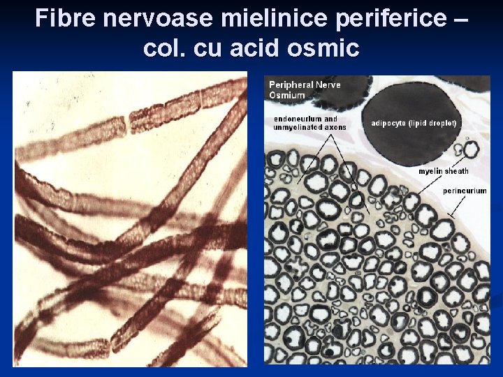 Fibre nervoase mielinice periferice – col. cu acid osmic 