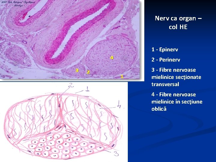 Nerv ca organ – col HE 1 - Epinerv 2 - Perinerv 3 -