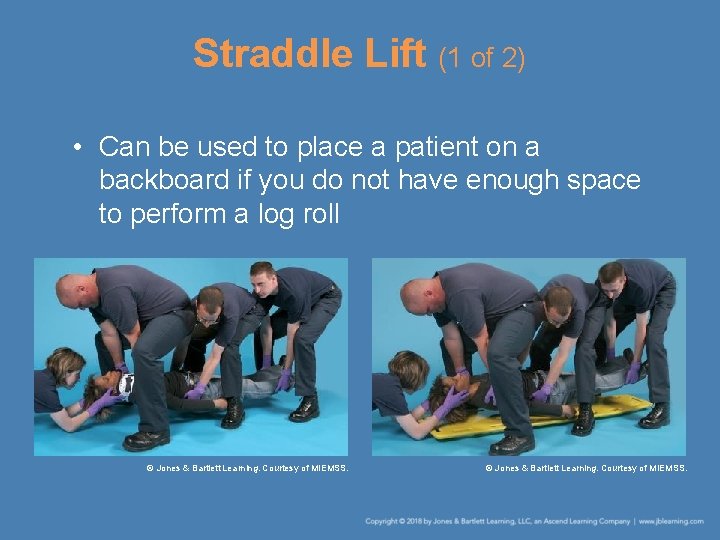 Straddle Lift (1 of 2) • Can be used to place a patient on