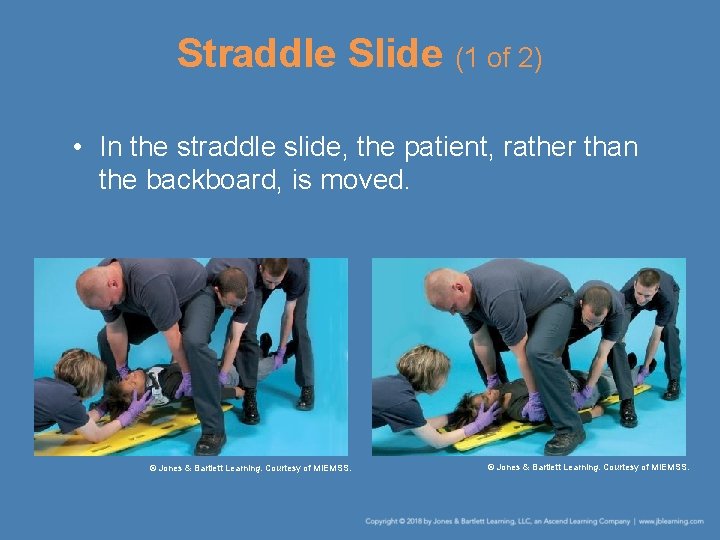 Straddle Slide (1 of 2) • In the straddle slide, the patient, rather than