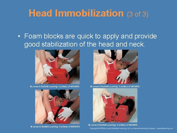 Head Immobilization (3 of 3) • Foam blocks are quick to apply and provide