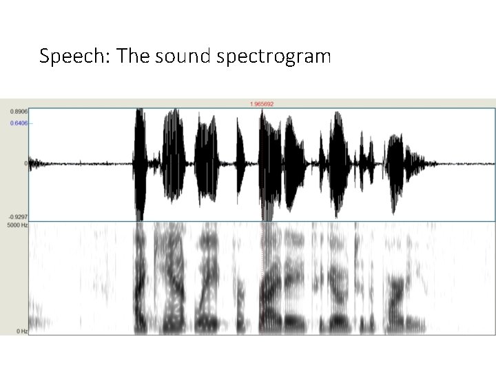 Speech: The sound spectrogram 