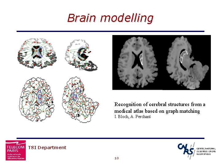 Brain modelling Recognition of cerebral structures from a medical atlas based on graph matching